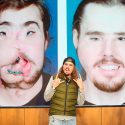 Nuevo rostro de Cameron Underwood: el antes y después del trasplante facial más avanzado del orbe