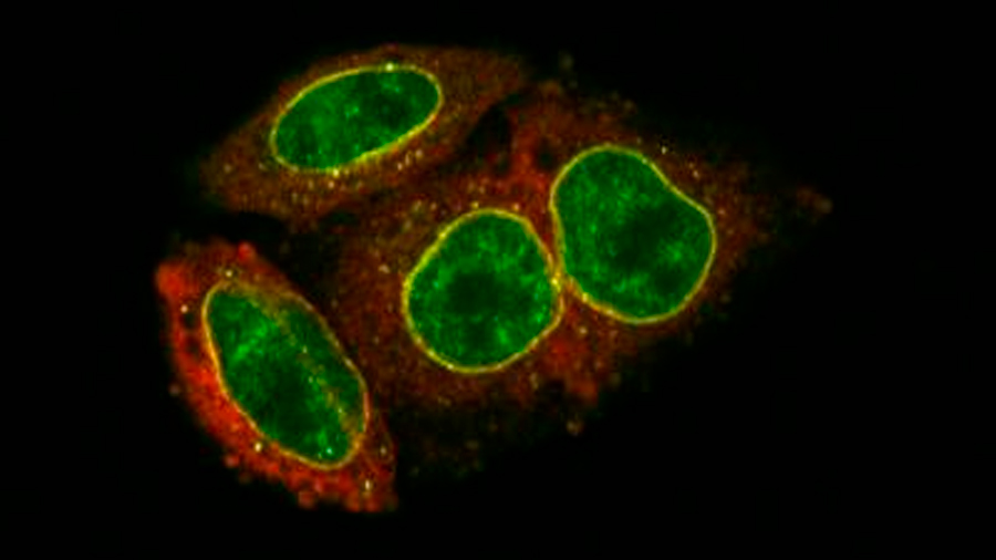 Identifican cómo impedir que el ADN del VIH entre al núcleo celular