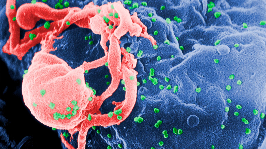 Descubren compuestos que bloquean la reactivación del VIH-1 latente