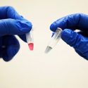 Científicos australianos inventaron un método que diagnostica el cáncer en 10 minutos
