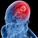 Científicos de Hong Kong descubren mecanismo de mutación de cáncer cerebral mortal