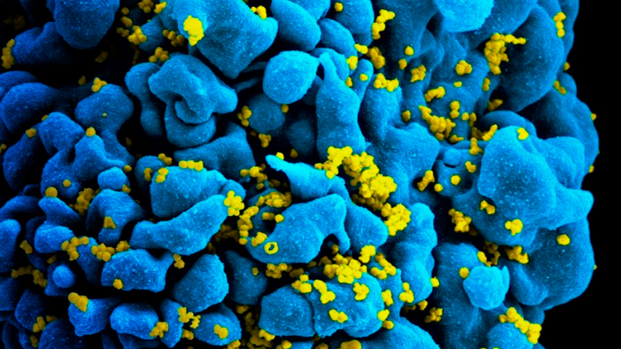 Identificadas pautas para crear anticuerpos universales que neutralicen el VIH y a su brutal mutación