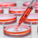 Confirmado el potencial de las células madre mesenquimales para tratar el lupus