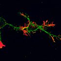Descubren neuronas que se autoprotegen contra las proteínas tóxicas del Alzheimer