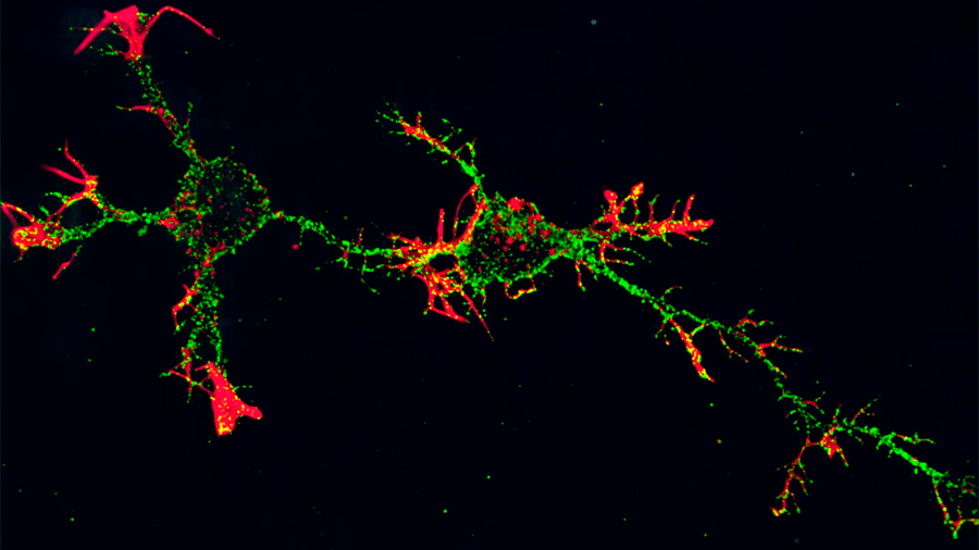 Descubren neuronas que se autoprotegen contra las proteínas tóxicas del Alzheimer