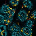Descubren la estrategia de las bacterias de neumonía para colonizar al huésped