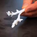 Médicos realizarán el primer trasplante de una tráquea impresa en 3D en el mundo