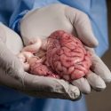 Científicos de Yale mantienen con vida los cerebros de cerdos decapitados durante 36 horas