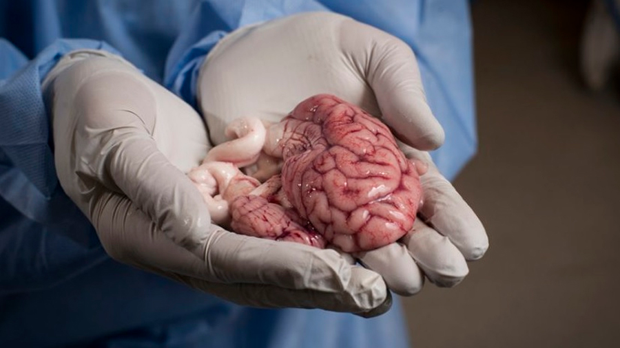 Científicos de Yale mantienen con vida los cerebros de cerdos decapitados durante 36 horas