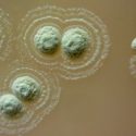 Un eficaz antídoto para súper bacterias hospitalarias, hallado en suelo 'medicinal'