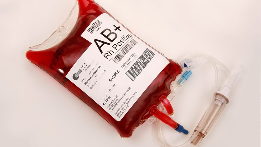Ambrosia ya realiza transfusiones de sangre “rejuvenecedora” en 6 ciudades de EU