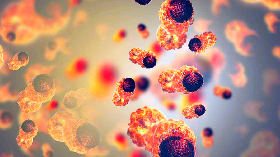 Transforman las células cancerosas en grasa para impedir metástasis