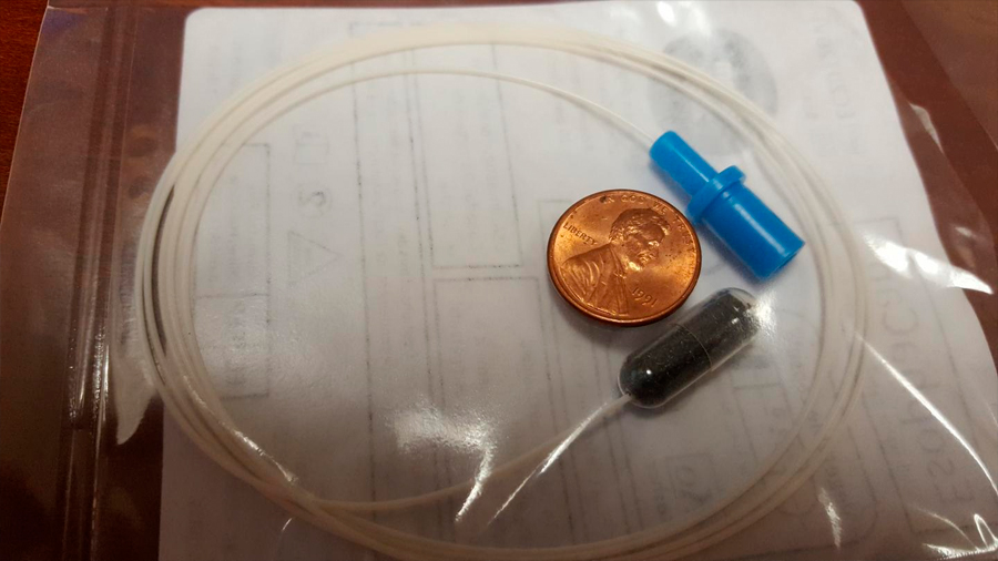Una cápsula, una cuerda y una esponja son el futuro de la detección del cáncer de esófago
