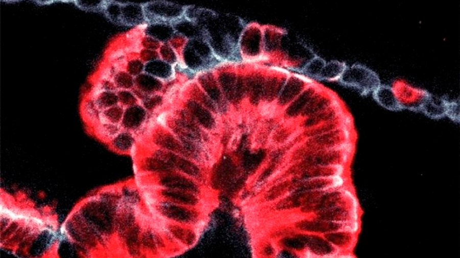 Una nueva técnica de imágenes en 3D revela cómo comienzan los cánceres de páncreas