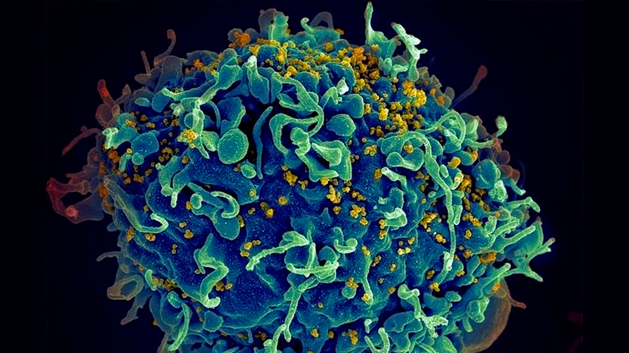 El VIH oculto en las células de los pacientes ahora puede medirse con precisión