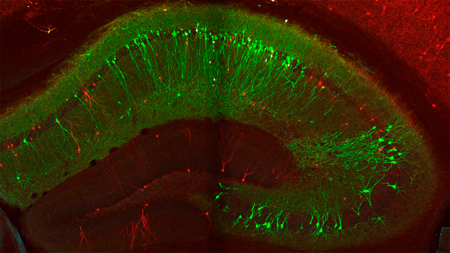 Identifican la localización precisa de las células que controlan el flujo de memoria del cerebro