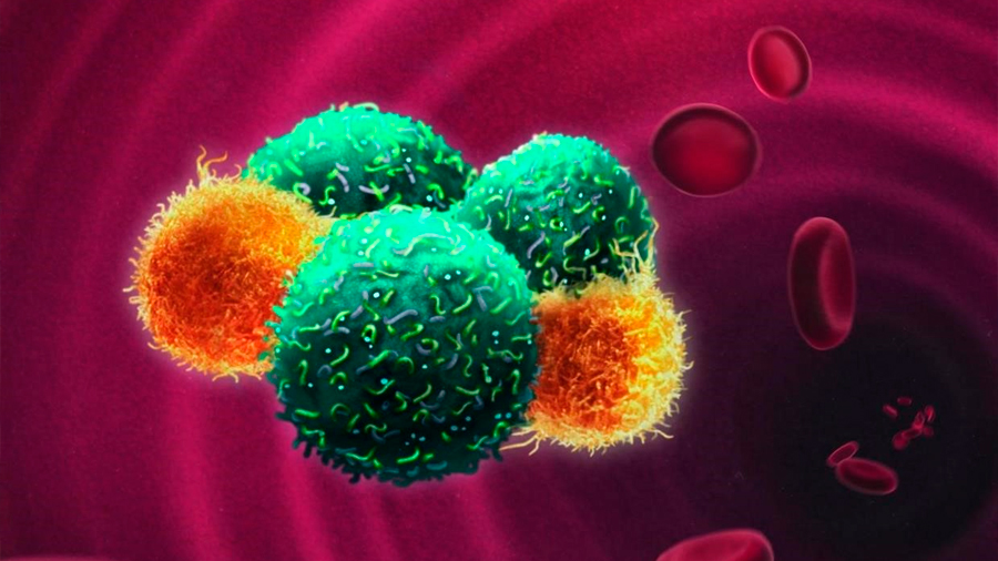 Identifican el papel de las células inmunes en la formación de metástasis