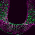 Descubren el origen cerebral de la obesidad