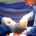 Médicos logran operar un feto fuera del vientre materno y volverlo a colocarlo dentro