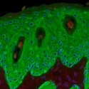 La inteligencia artificial identifica 63 nuevos genes asociados al cáncer