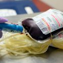 EU advierte sobre el uso de sangre joven para “rejuvenecer”