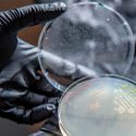 Logran un microbio de diseño prometedor para producir plástico de las plantas