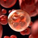 Científicos israelíes descubren nuevo método para predecir la extensión del melanoma