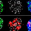 Crean nueva terapia contra la diabetes a base de células pancreáticas humanas reprogramadas