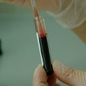 Inventan un análisis de sangre para medir el dolor que sentimos