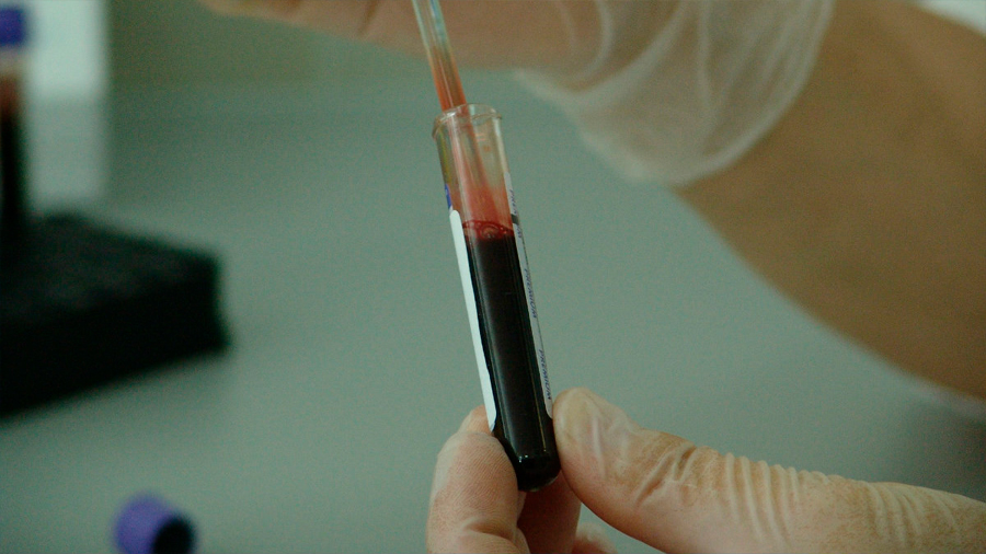 Inventan un análisis de sangre para medir el dolor que sentimos