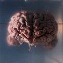 Conserve su cerebro para siempre sometiéndose a suicidio asistido