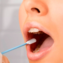 La genética influye más que la obesidad para el desarrollo de la diabetes en los mexicanos