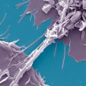 El VIH se mueve entre las células a través de nanotubos en presencia de la tuberculosis