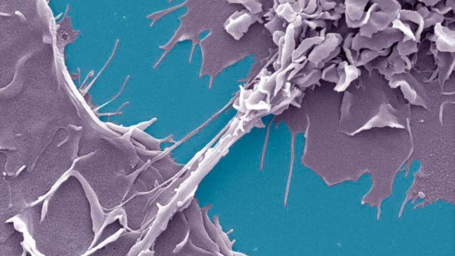 El VIH se mueve entre las células a través de nanotubos en presencia de la tuberculosis