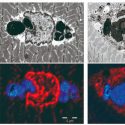 Descubren una nueva enfermedad muscular causada por una mutación genética