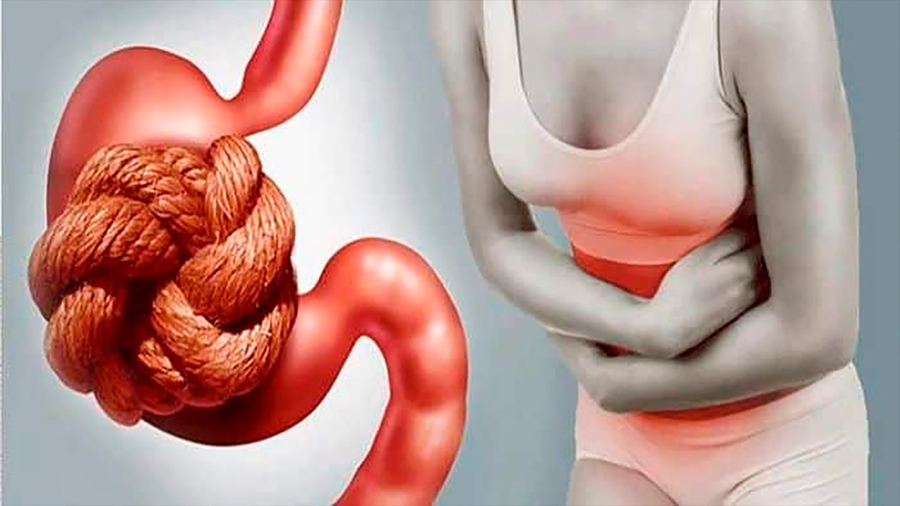 La diabetes puede propiciar estreñimiento y dañar las terminales nerviosas al interior del intestino