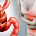 La diabetes puede propiciar estreñimiento y dañar las terminales nerviosas al interior del intestino