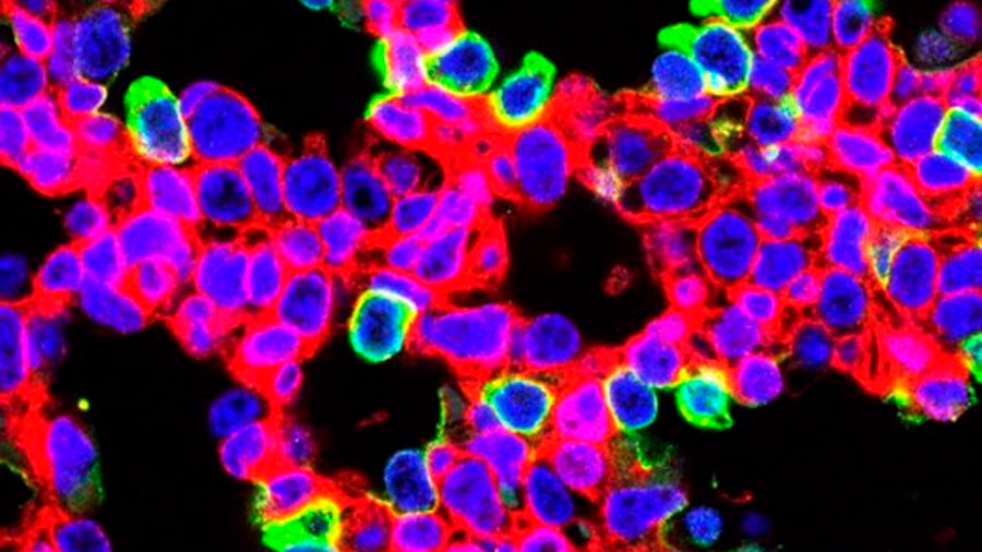 Nueva terapia con CRISPR para ‘curar’ una enfermedad pulmonar mortal en ratones