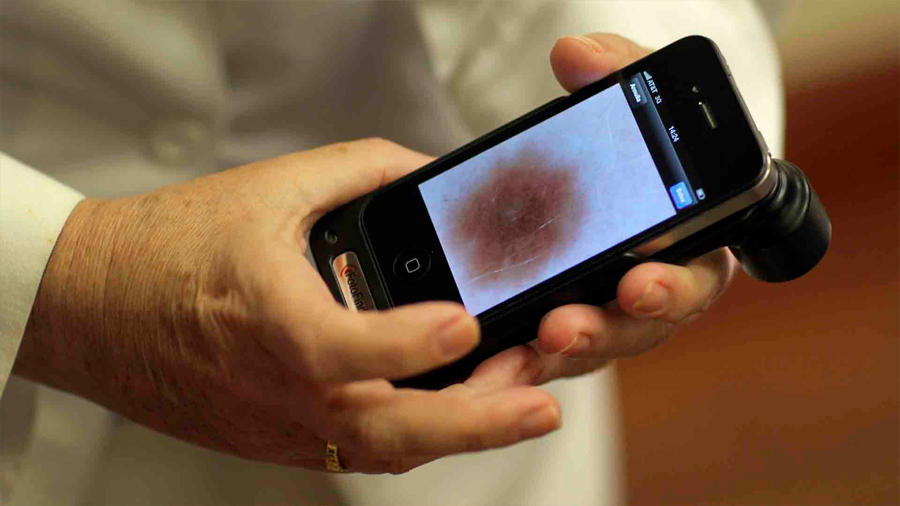 Una app diagnostica el cáncer de cuello uterino a partir de imágenes
