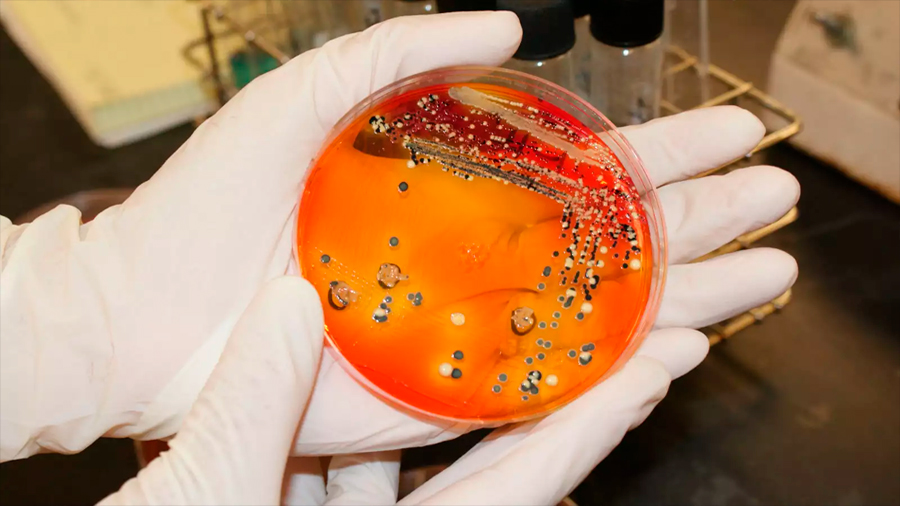 Científicos alemanes identifican bacteria que protege contra salmonela