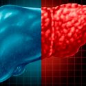 Un fármaco experimental mejora la diabetes tipo 2 y el hígado graso