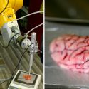 Crea investigador mexicano un bisturí inteligente que detecta tumores cerebrales