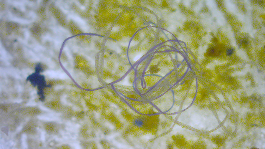 Plancton tóxico prefiere crecer en microplásticos