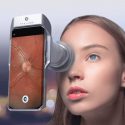 Un aparato portátil permite diagnosticar enfermedades oculares a distancia