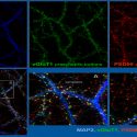 Una proteína cerebral promueve la interconectividad neuronal