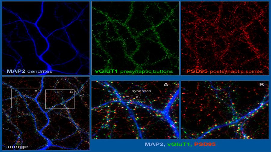 Una proteína cerebral promueve la interconectividad neuronal