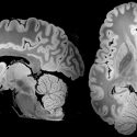 Logran visualizar el cerebro a detalle más completo tras una resonancia magnética de 100 horas