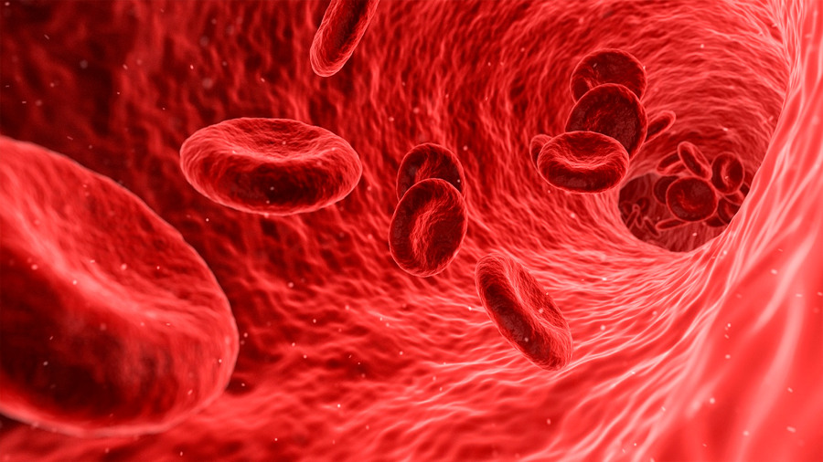 Investigadores descubren nuevas causas de las placas en las arterias