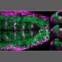 Las fuerzas mecánicas controlan el destino celular durante la formación del cerebro