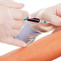 Crean análisis de sangre que detecta el alzhéimer hasta 20 años antes que se manifiesten sus síntomas